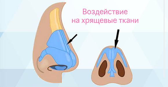 Усталость при гельминтах